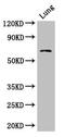 Bardet-Biedl Syndrome 1 antibody, CSB-PA836736LA01HU, Cusabio, Western Blot image 