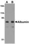 Albumin antibody, MBS151044, MyBioSource, Western Blot image 