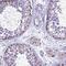 CysRS antibody, PA5-59722, Invitrogen Antibodies, Immunohistochemistry paraffin image 
