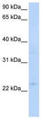 TNF Receptor Superfamily Member 18 antibody, TA330342, Origene, Western Blot image 