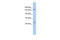 Activity Dependent Neuroprotector Homeobox antibody, ARP39186_P050, Aviva Systems Biology, Western Blot image 