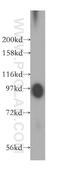 Plasminogen antibody, 16776-1-AP, Proteintech Group, Western Blot image 