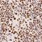 Heterogeneous Nuclear Ribonucleoprotein M antibody, NB200-315, Novus Biologicals, Immunohistochemistry frozen image 