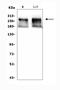 ATRX Chromatin Remodeler antibody, A00203-2, Boster Biological Technology, Western Blot image 