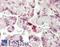 Lin-28 Homolog A antibody, LS-B14215, Lifespan Biosciences, Immunohistochemistry paraffin image 