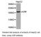 Alpha-2-macroglobulin antibody, LS-C193013, Lifespan Biosciences, Western Blot image 