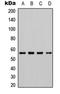 Checkpoint Kinase 1 antibody, LS-C358948, Lifespan Biosciences, Western Blot image 