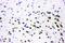 Activating Transcription Factor 2 antibody, PB9131, Boster Biological Technology, Immunohistochemistry paraffin image 
