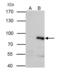 P21 (RAC1) Activated Kinase 6 antibody, GTX107861, GeneTex, Immunoprecipitation image 