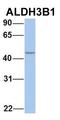 Aldehyde Dehydrogenase 3 Family Member B1 antibody, orb330746, Biorbyt, Western Blot image 