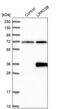 Leucine Rich Repeat Containing 3B antibody, PA5-53323, Invitrogen Antibodies, Western Blot image 