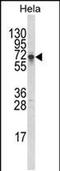 Deltex E3 Ubiquitin Ligase 1 antibody, PA5-49658, Invitrogen Antibodies, Western Blot image 