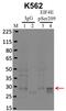 Eukaryotic Translation Initiation Factor 4E antibody, 44-528G, Invitrogen Antibodies, Immunoprecipitation image 