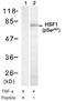 Heat Shock Transcription Factor 1 antibody, LS-C203028, Lifespan Biosciences, Western Blot image 