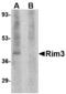 Regulating Synaptic Membrane Exocytosis 3 antibody, MBS150119, MyBioSource, Western Blot image 