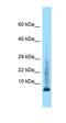 LSM8 Homolog, U6 Small Nuclear RNA Associated antibody, orb326340, Biorbyt, Western Blot image 