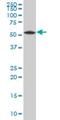 Vacuolar Protein Sorting 4 Homolog B antibody, H00009525-A01, Novus Biologicals, Western Blot image 