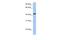 IGF Like Family Receptor 1 antibody, A15103, Boster Biological Technology, Western Blot image 