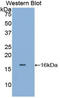 Tryptase antibody, LS-C708960, Lifespan Biosciences, Western Blot image 