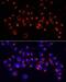 Alanyl-TRNA Synthetase antibody, LS-C749990, Lifespan Biosciences, Immunofluorescence image 