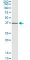 Cellular Communication Network Factor 2 antibody, LS-C196995, Lifespan Biosciences, Western Blot image 