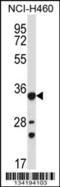 Aldo-Keto Reductase Family 1 Member B10 antibody, 57-496, ProSci, Western Blot image 