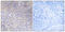 Mitochondrial Ribosomal Protein L11 antibody, GTX87823, GeneTex, Immunohistochemistry paraffin image 