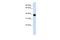 Sphingolipid delta(4)-desaturase DES1 antibody, A05502, Boster Biological Technology, Western Blot image 