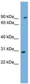 Phytanoyl-CoA dioxygenase, peroxisomal antibody, TA345152, Origene, Western Blot image 