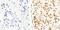 Insulin Receptor Substrate 1 antibody, GTX24776, GeneTex, Immunohistochemistry paraffin image 