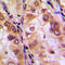 Histone Deacetylase 8 antibody, LS-C354196, Lifespan Biosciences, Immunohistochemistry paraffin image 