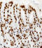 Histone Cluster 1 H2A Family Member M antibody, 61-041, ProSci, Immunohistochemistry frozen image 