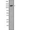 Nucleoporin 98 antibody, abx217294, Abbexa, Western Blot image 