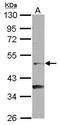 Nuclear receptor subfamily 6 group A member 1 antibody, GTX100883, GeneTex, Western Blot image 