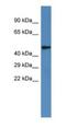 Iroquois Homeobox 6 antibody, NBP1-79258, Novus Biologicals, Western Blot image 