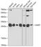 Guanidinoacetate N-Methyltransferase antibody, GTX33215, GeneTex, Western Blot image 