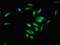 Involucrin antibody, CSB-PA011922LA01HU, Cusabio, Immunofluorescence image 