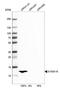 S100 Calcium Binding Protein A16 antibody, NBP1-92361, Novus Biologicals, Western Blot image 