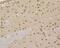 MutS Homolog 2 antibody, NBP2-76896, Novus Biologicals, Immunohistochemistry paraffin image 