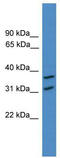 OTU Deubiquitinase 6A antibody, TA342555, Origene, Western Blot image 