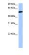 High Mobility Group 20A antibody, orb329689, Biorbyt, Western Blot image 