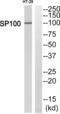 SP100 Nuclear Antigen antibody, abx014668, Abbexa, Western Blot image 