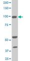 10-FTHFDH antibody, H00010840-M01, Novus Biologicals, Western Blot image 