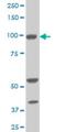 Aldehyde Dehydrogenase 1 Family Member L1 antibody, H00010840-M01, Novus Biologicals, Western Blot image 