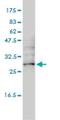 Ubiquitin Domain Containing 2 antibody, H00092181-M01, Novus Biologicals, Western Blot image 