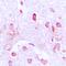 Cell Division Cycle 37 antibody, orb215040, Biorbyt, Immunohistochemistry paraffin image 