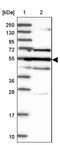 Galactose-3-O-Sulfotransferase 4 antibody, PA5-58262, Invitrogen Antibodies, Western Blot image 