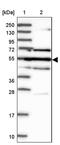 Galactose-3-O-Sulfotransferase 4 antibody, PA5-58262, Invitrogen Antibodies, Western Blot image 