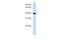 Tropomodulin 3 antibody, A07431, Boster Biological Technology, Western Blot image 