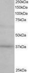 ATPase H+ Transporting Accessory Protein 2 antibody, PA1-32079, Invitrogen Antibodies, Western Blot image 